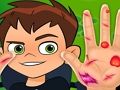 Jeu Médecin de la main Ben10  en ligne