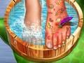 Jeu Médecin de la peau des pieds  en ligne
