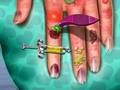 Jeu Médecin de la peau des mains  en ligne