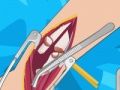 Jeu Chirurgie du bras 2 en ligne Jeu Chirurgie du bras 2 en ligne