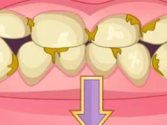 Jeu Bad Teeth Makeover en ligne