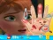 Jeu Anna hand doctor en ligne