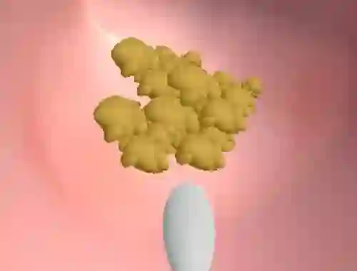 Jeu Earwax Clinic en ligne
