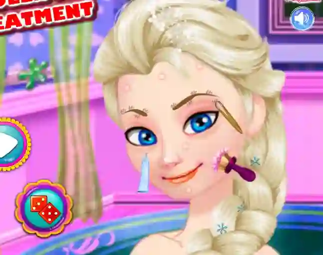 Jeu Ice Queen Acne Treatment en ligne