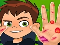 Jeu Médecin de la main Ben10  en ligne