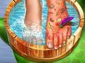 Jeu Médecin de la peau des pieds  en ligne